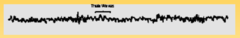 Characteristics of Stage 1 sleep EEG