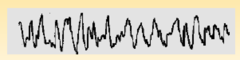 Characteristics of Stage 3 sleep EEG