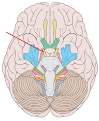 CNIII-3