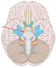 CNIV-4