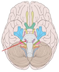 CNVI-6