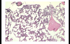 Core biopsy image