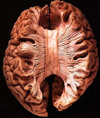 Corpus Callosum