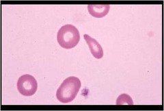 Dacryocyte