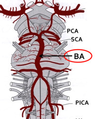 Describe the branches of the basillar artery (4)