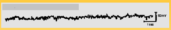 EEG: What are the characteristics of alertness?