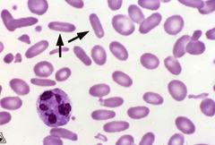 Elliptocyte