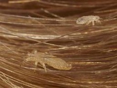 Lice (pediculosis capitis)