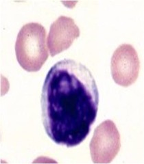 Lymphocyte