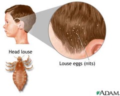 Pediculosis capitus= head lice  Might see nits, louse picture