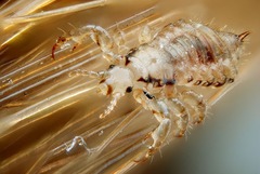 Pediculus humanus capitis (head louse)