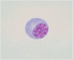 Plasma Cell