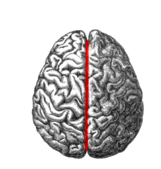 Sagittal Slice