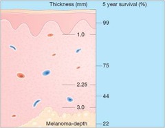 Survival Statistics Based on Melanoma Depth