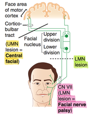 UMN Facial Lesion