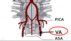 What are the branches of the vertebral artries? where do they join?