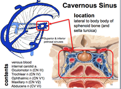 Cavernous Sinus