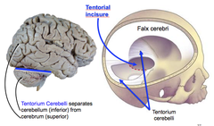 Dural Folds