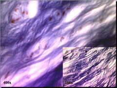 Fibrocartilage