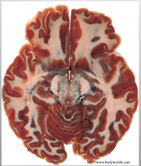 Gray and White Matter in the Cerebrum