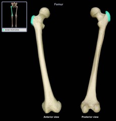 greater trochanter