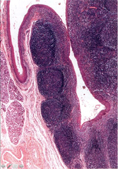 Histology of Tonsils