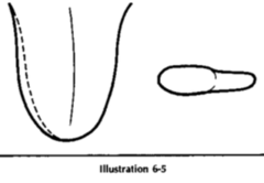 If the tongue body is *SWOLLEN on Half of the Tongue*, what might that indicate?