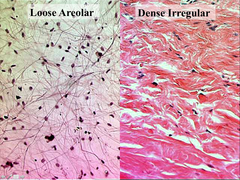 Loose Areolar vs. Dense Irregular Connective Tissue