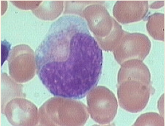 Metamyelocyte