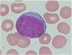 Myeloblast