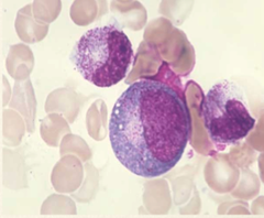 Myelocyte