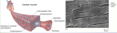 Net-like organization of cardiac muscle