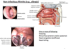 Non-Infectious Rhinitis