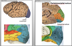 Occipital Lobe Subdivisions - Visual Cortex