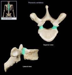 pedicle