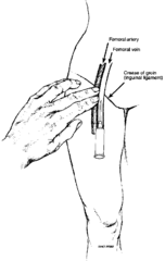 Peripheral Pulse Sites: Lower Body