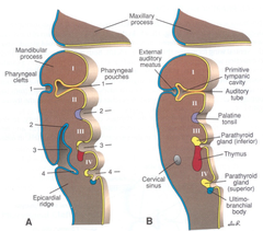 Pharyngeal pouches