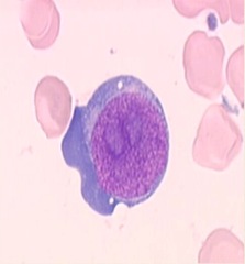 RBC begins as a proerythroblast