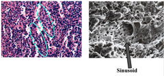 Red Pulp of Spleen