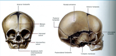 Skull Growth