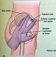 Ventrogluteal Injection Site
