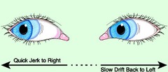 What is nystagmus? is this normal for the newborn?