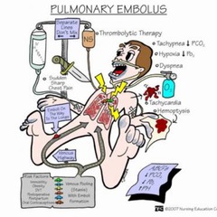 Air/Pulmonary Embolism