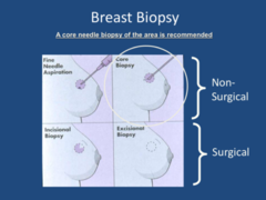 Breast Biopsy