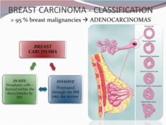 Breast carcinoma-In situ