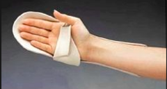 Claw deformity: Ulnar nerve laceration/injury POST-OP: OT intervention