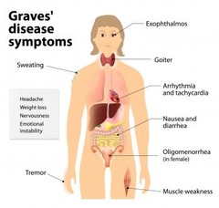 Clinical detection Graves Disease