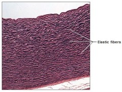 Dense elastic connective tissue