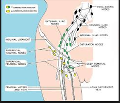 Describe the 4 stages of lymphatic drainage of the penis.