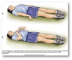 Dominant Components: (UE flexor synergy)